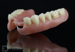 Breflex proteza Full Dent