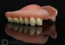 Breflex proteza lab Full Dent