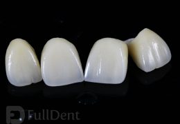 Ceramic crowns Full Dent lab