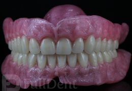 Full denture