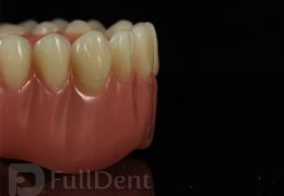 Full dentures acrylic base