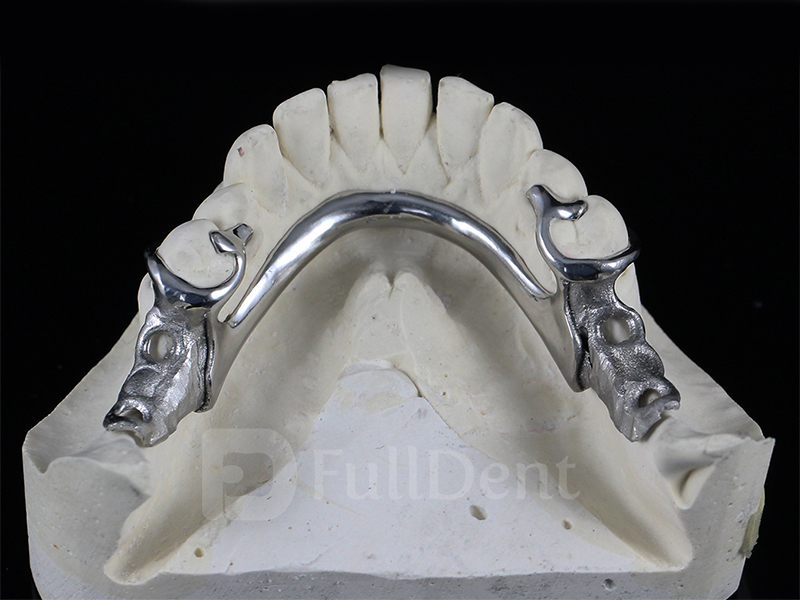 Partial Skeletal Dentures